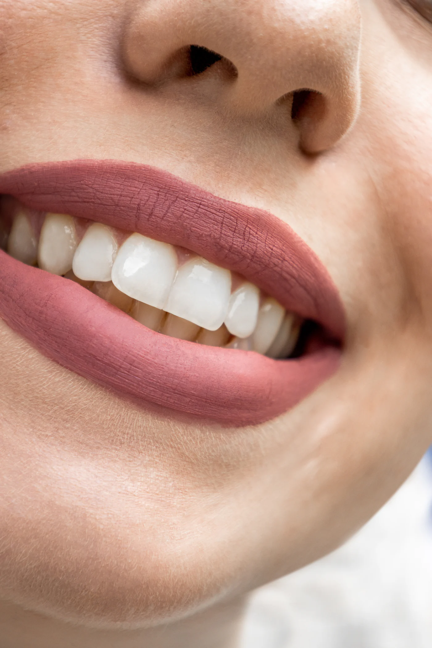 Sorriso con denti bianchi e curati